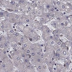Immunohistochemical staining of human liver using Anti-IKBIP antibody HPA038678.