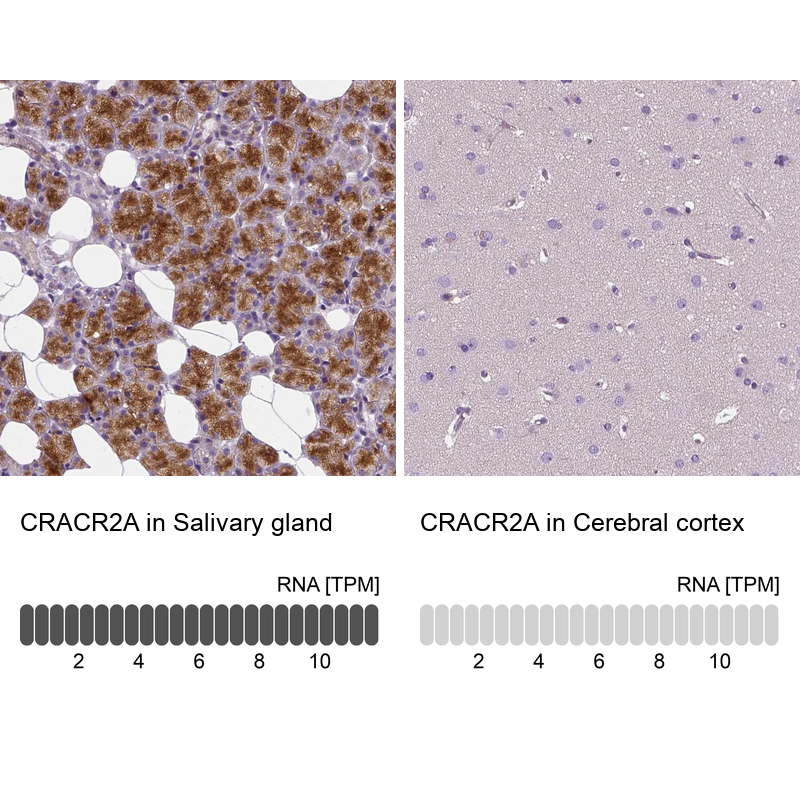 Anti-CRACR2A Antibody