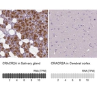 Anti-CRACR2A Antibody