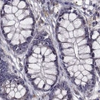 Immunohistochemical staining of human colon using Anti-IKBIP antibody HPA038678.