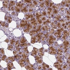 Anti-CRACR2A Antibody