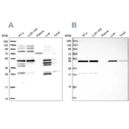 Western blot analysis using Anti-IKBIP antibody HPA038678 (A) shows similar pattern to independent antibody HPA038677 (B).