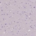 Anti-CRACR2A Antibody
