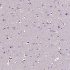 Immunohistochemical staining of human cerebral cortex shows low expression as expected.