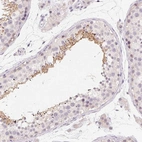 Immunohistochemical staining of human testis shows high expression.