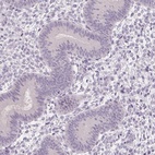 Anti-CAPZA3 Antibody