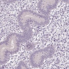 Immunohistochemical staining of human endometrium shows low expression as expected.