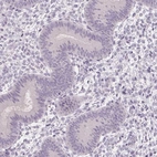 Immunohistochemical staining of human endometrium shows low expression as expected.