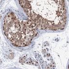 Anti-PSMD13 Antibody