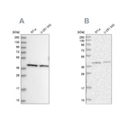 Western blot analysis using Anti-PSMD13 antibody HPA038691 (A) shows similar pattern to independent antibody HPA038692 (B).