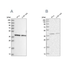 Western blot analysis using Anti-PSMD13 antibody HPA038691 (A) shows similar pattern to independent antibody HPA038692 (B).