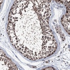 Anti-PSMD13 Antibody
