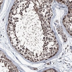 Anti-PSMD13 Antibody