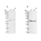 Western blot analysis using Anti-PSMD13 antibody HPA038692 (A) shows similar pattern to independent antibody HPA038691 (B).
