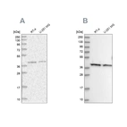 Western blot analysis using Anti-PSMD13 antibody HPA038692 (A) shows similar pattern to independent antibody HPA038691 (B).