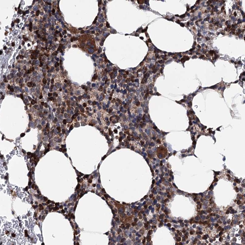 Anti-FGFR1OP2 Antibody