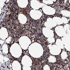 Anti-FGFR1OP2 Antibody