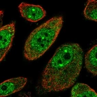 Immunofluorescent staining of human cell line PC-3 shows localization to nucleoplasm & nuclear bodies.