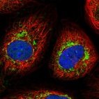 Immunofluorescent staining of human cell line A-431 shows localization to mitochondria.
