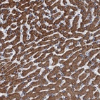 Anti-TRPT1 Antibody