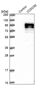Western blot analysis in control (vector only transfected HEK293T lysate) and CCDC82 over-expression lysate (Co-expressed with a C-terminal myc-DDK tag (~3.1 kDa) in mammalian HEK293T cells, LY411122).