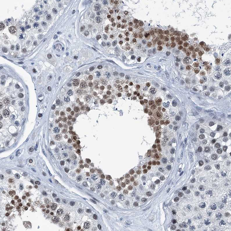 Anti-TRPT1 Antibody