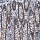 Immunohistochemical staining of human colon shows strong nuclear positivity in glandular cells.