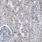 Immunohistochemical staining of human kidney shows strong nuclear positivity in cells in tubules.