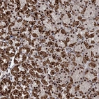 Anti-MORN3 Antibody