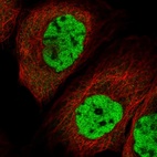 Immunofluorescent staining of human cell line A-431 shows localization to nucleoplasm.