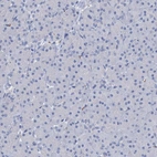 Immunohistochemical staining of human pancreas shows no positivity in exocrine glandular cells as expected.