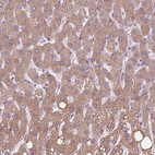 Immunohistochemical staining of human liver shows weak granular cytoplasmic positivity in hepatocytes.