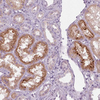 Immunohistochemical staining of human kidney shows moderate granular cytoplasmic positivity in cells in tubules.