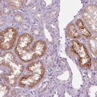 Immunohistochemical staining of human kidney shows moderate granular cytoplasmic positivity in cells in tubules.