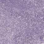 Immunohistochemical staining of human tonsil shows no positivity in non-germinal center cells as expected.