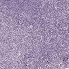 Immunohistochemical staining of human tonsil shows no positivity in non-germinal center cells as expected.
