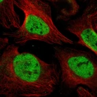 Anti-UNC93B1 Antibody