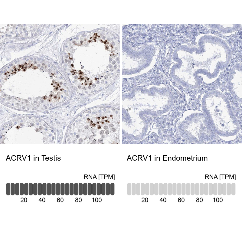 Anti-ACRV1 Antibody