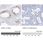 Anti-ACRV1 Antibody