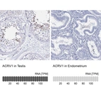 Anti-ACRV1 Antibody