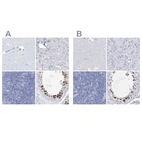 Immunohistochemical staining of human cerebral cortex, liver, lymph node and testis using Anti-ACRV1 antibody HPA038718 (A) shows similar protein distribution across tissues to independent antibody HPA038719 (B).