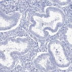 Immunohistochemical staining of human endometrium shows low expression as expected.