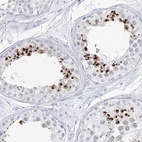 Immunohistochemical staining of human testis shows high expression.