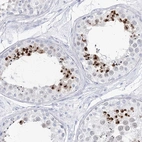Immunohistochemical staining of human testis shows high expression.