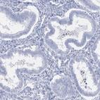 Immunohistochemical staining of human endometrium shows low expression as expected.