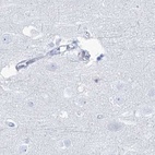 Immunohistochemical staining of human cerebral cortex using Anti-ACRV1 antibody HPA038718.