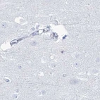 Immunohistochemical staining of human cerebral cortex using Anti-ACRV1 antibody HPA038718.