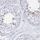 Immunohistochemical staining of human testis shows high expression.