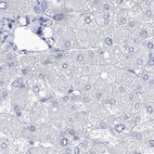 Immunohistochemical staining of human liver using Anti-ACRV1 antibody HPA038718.