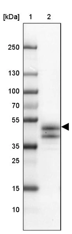 Lane 1: Marker [kDa] 250, 130, 100, 70, 55, 35, 25, 15, 10_br/_Lane 2: Human Testis tissue
